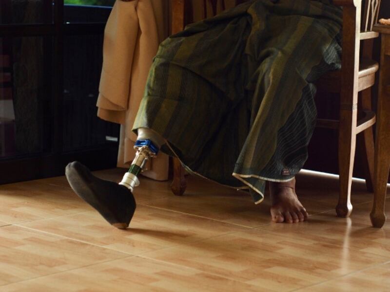 Taufik Abdul Halim wears a prosthetic leg during the BenarNews interview in Johor, Malaysia, Jan. 27, 2019. [Hadi Azmi/BenarNews]